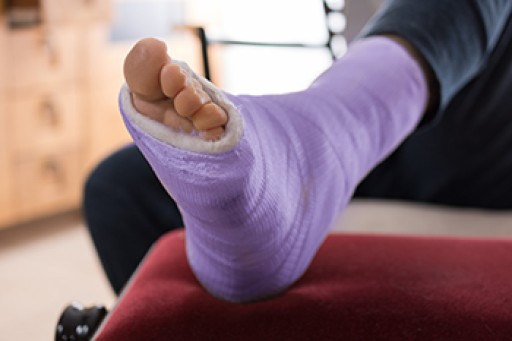 Broken Ankle Causes, Differences, Symptoms and Treatments