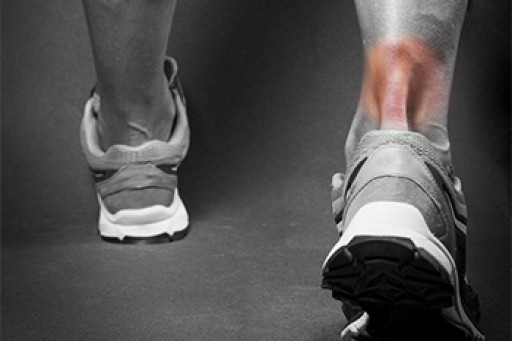 The Causes, Types, and Treatments of Achilles Tendon Injuries