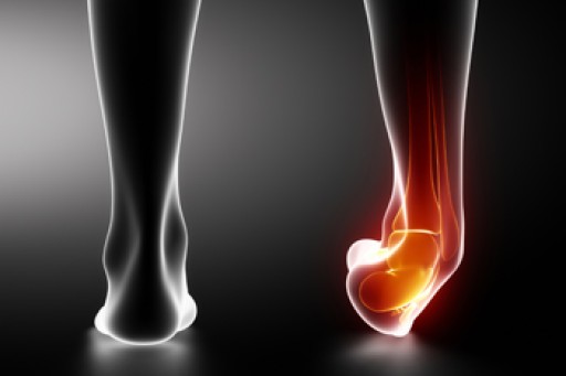 Types of Ankle Fractures